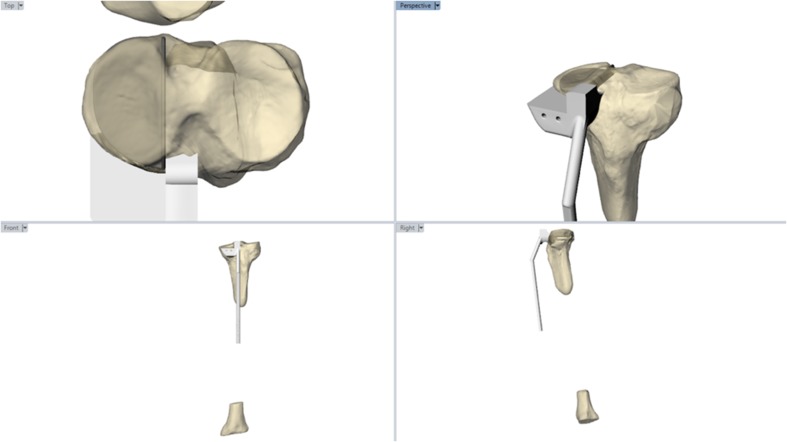 Fig. 2