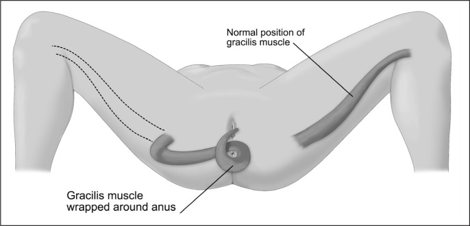 Figure 12.