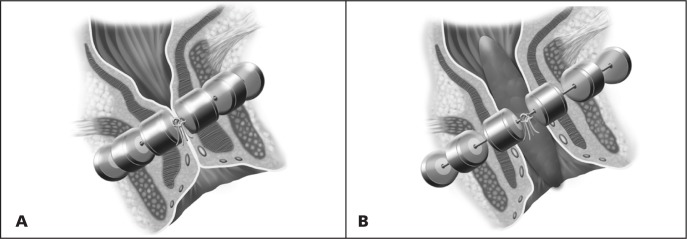 Figure 14.