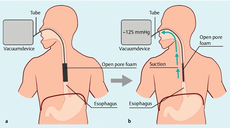 Fig. 3