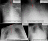 Fig. 9