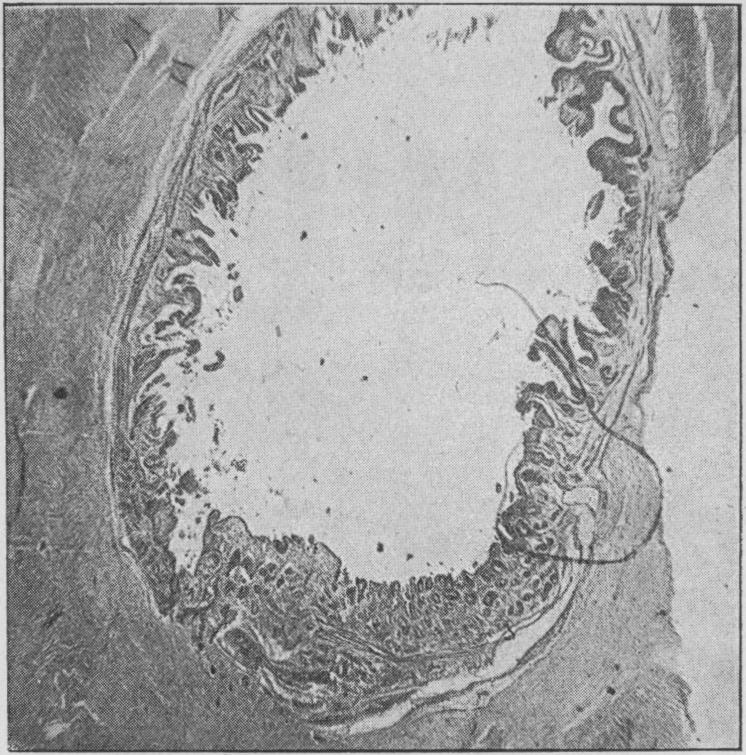 Fig. 35