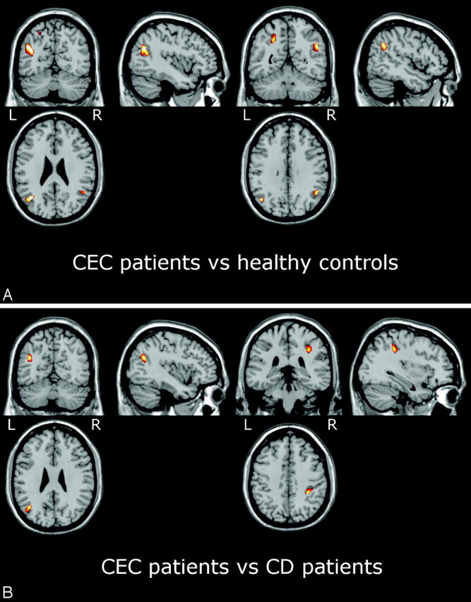 Fig 3.