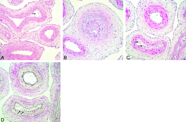 Fig 5.