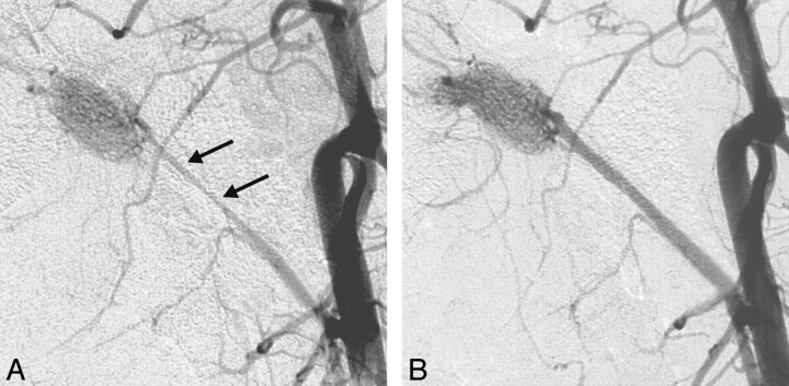 Fig 2.