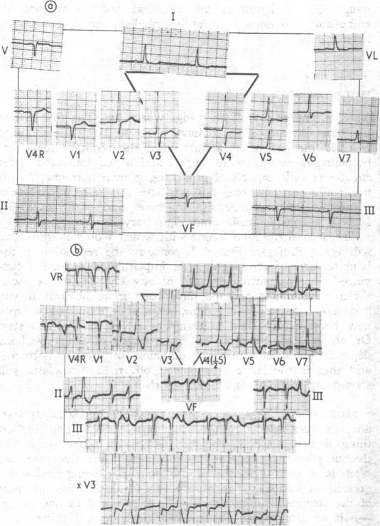 FIG. 4a and 4b