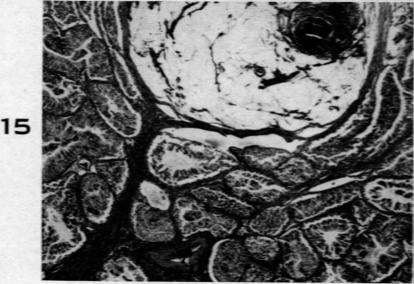 Fig. 15