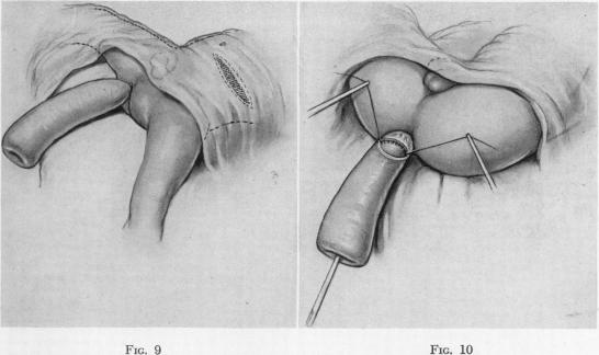 Fig. 9., Fig. 10.