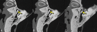 Fig 4.