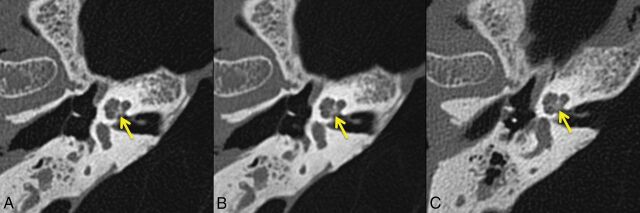 Fig 2.