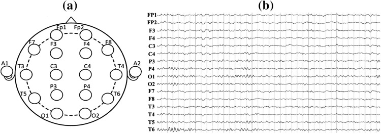 Fig. 1