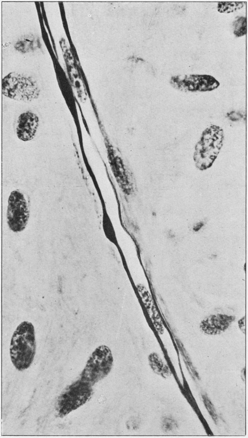 Fig. 11