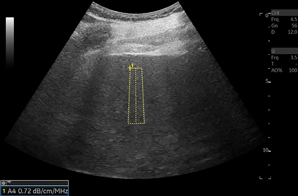 Figure 3: