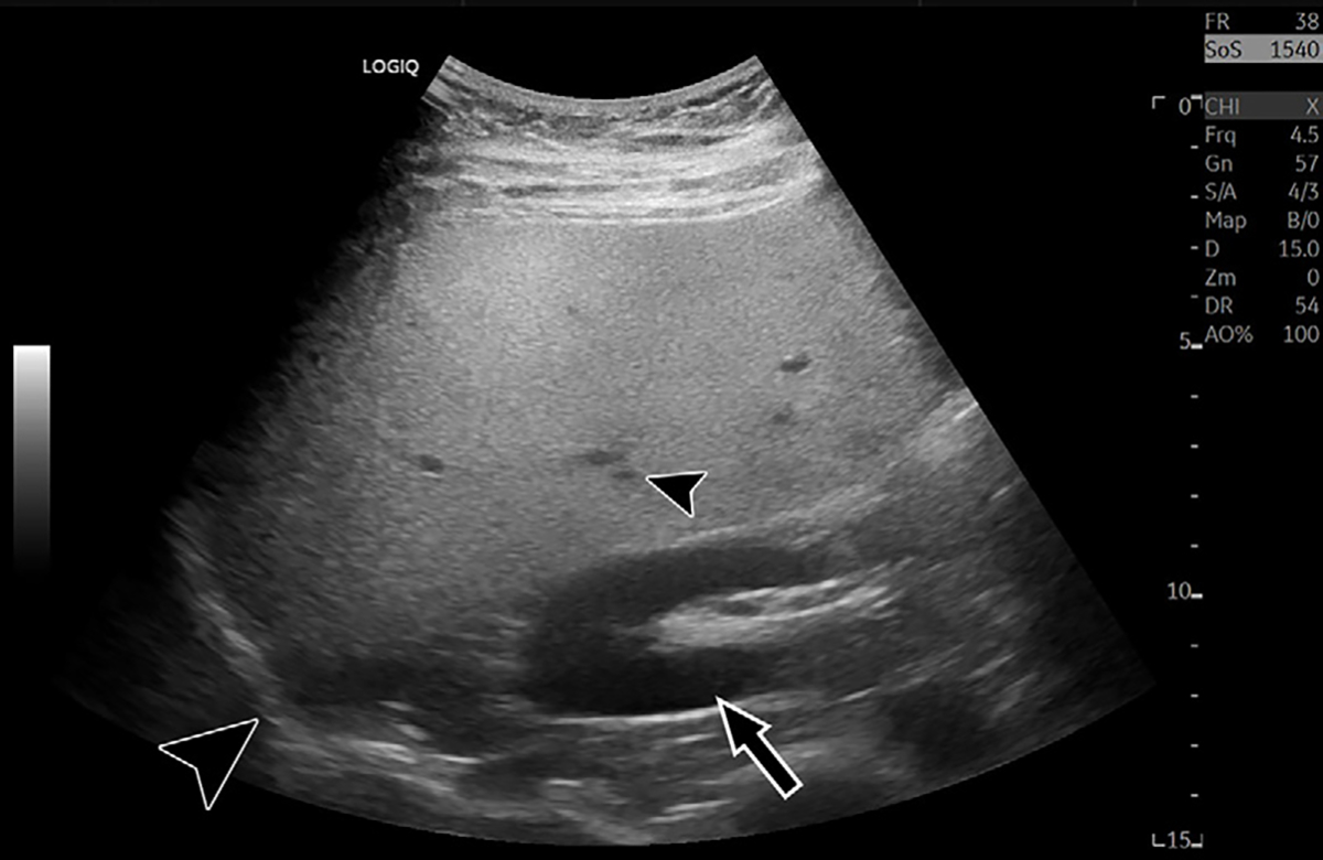 Figure 1: