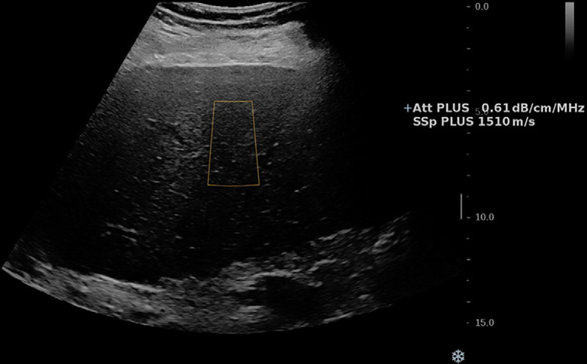 Figure 4: