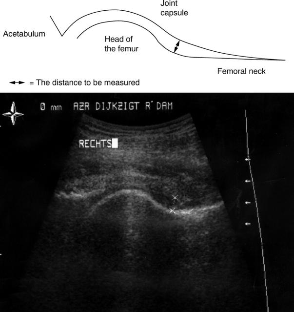 Figure 1  