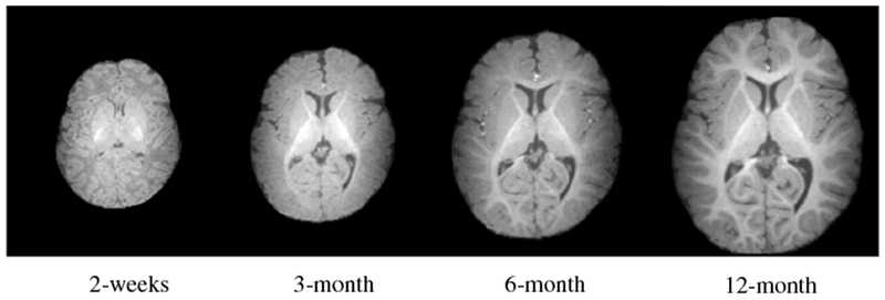 Fig. 1: