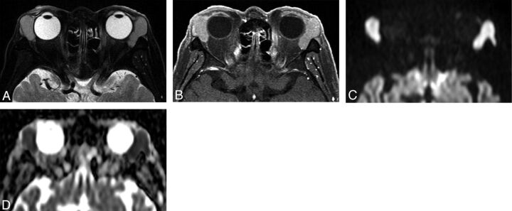 Fig 3.