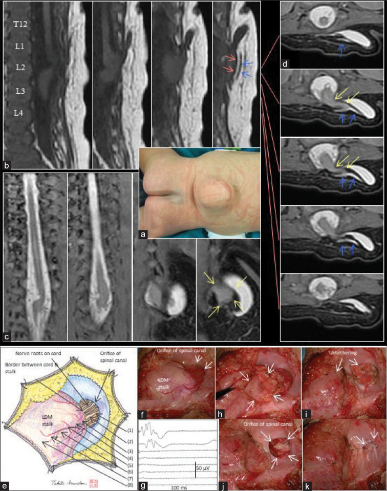 Figure 2: