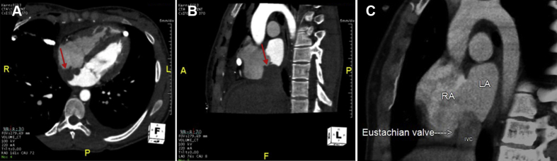 Figure 3