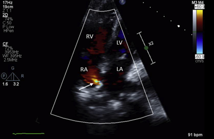 Figure 2