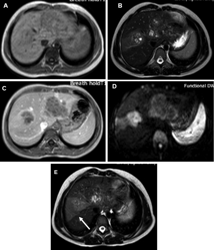 Figure 3