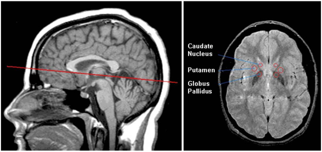 Fig. 1