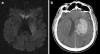 Fig. 5