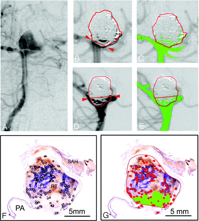 Fig 2.