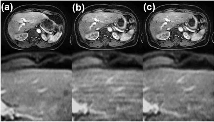 Fig. 12