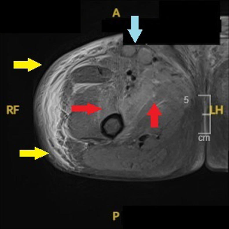 Fig 4