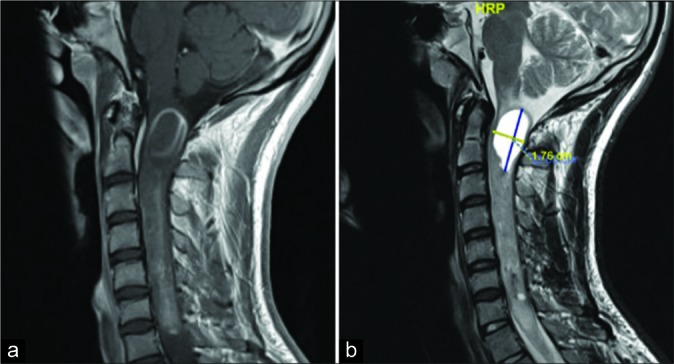 Figure 3: