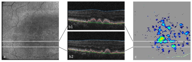 Fig. 16