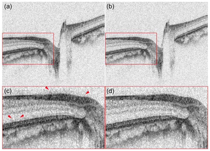 Fig. 11