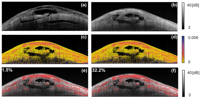 Fig. 12