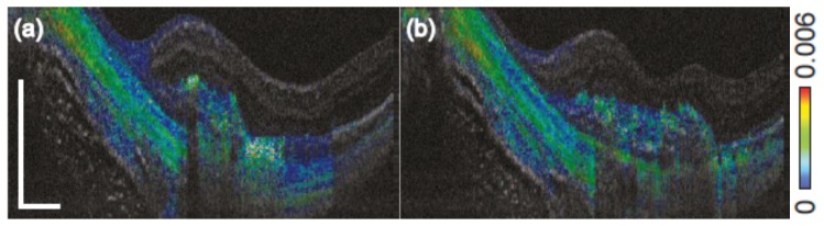 Fig. 19