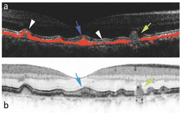 Fig. 17