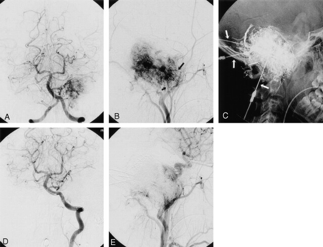 Fig 3.