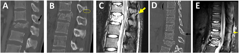 Figure 14.