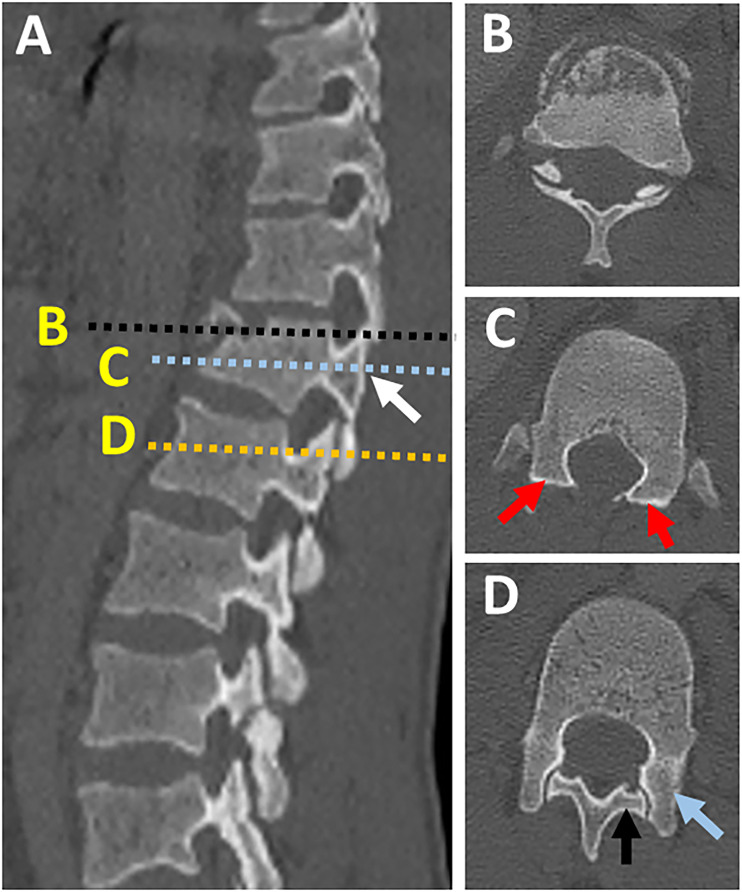 Figure 11.