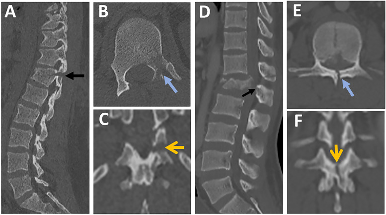 Figure 13.