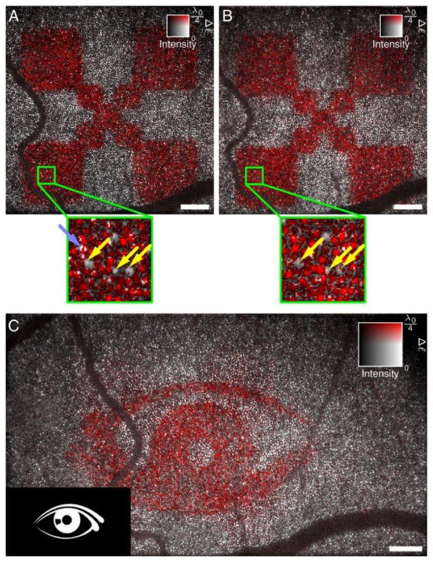 Fig. 11