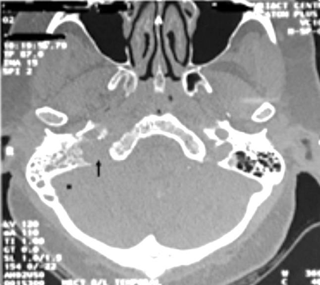 Fig. 1