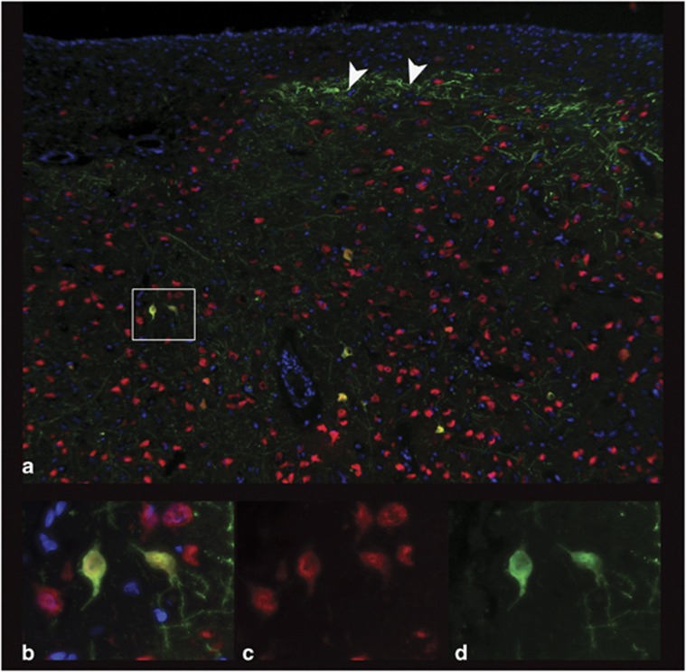 Figure 4