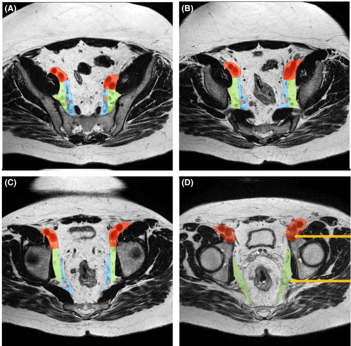 FIGURE 1