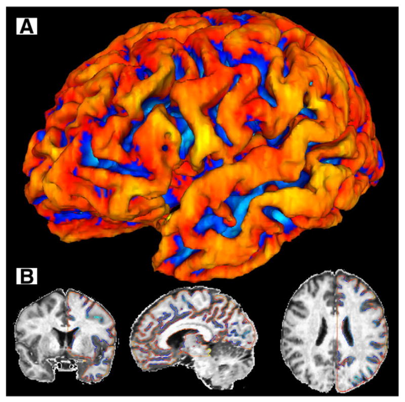 Fig. 1