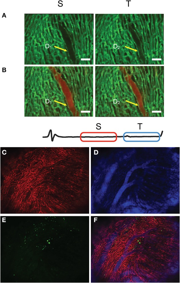 Figure 14