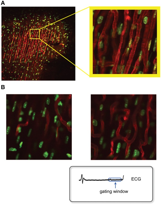 Figure 13