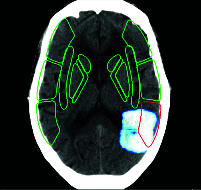 FIG 3.