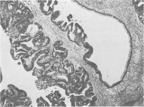 Fig. 2c.